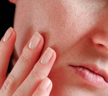 Sensitive vs Sensitized Skin – Know Your Skin
