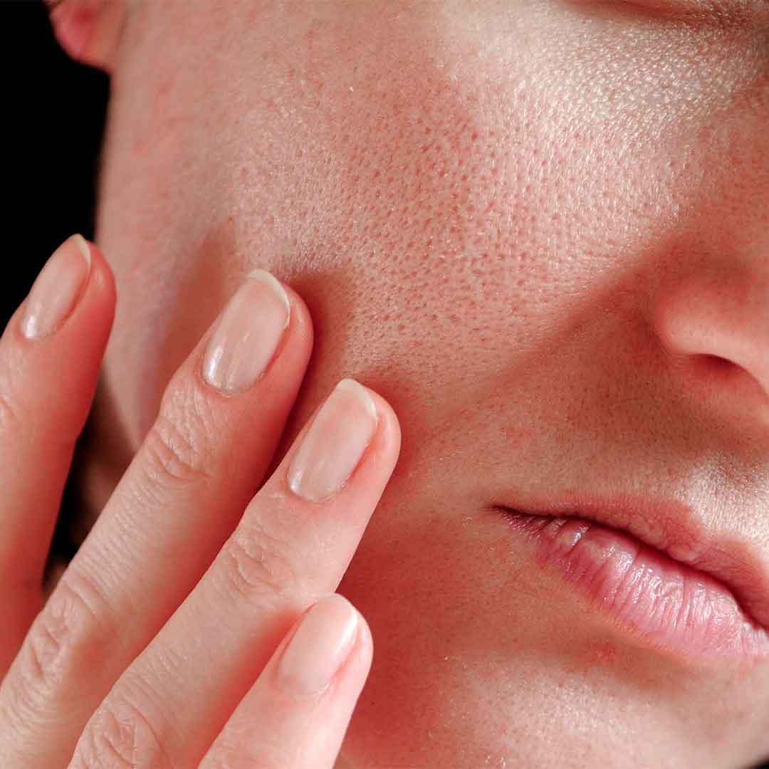 Sensitive vs Sensitized Skin – Know Your Skin