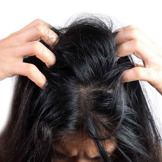 Head Lice Treatments and Home Remedies