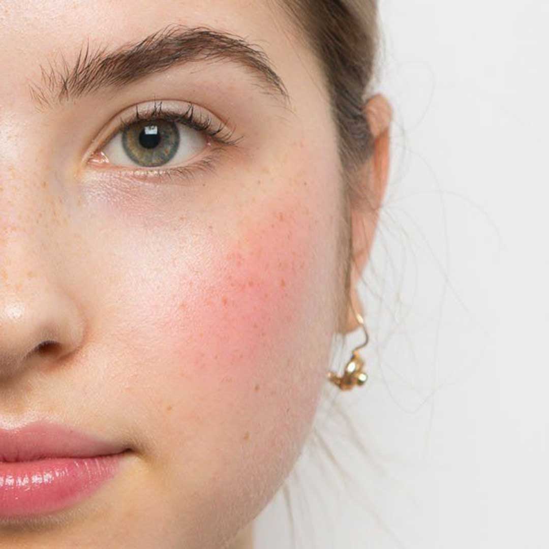 How to Get a Natural Blush on Your Cheeks